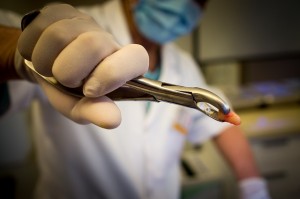 Dentista com dente extraído